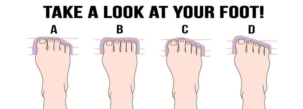 Take_a_look_at_your_foot_carefully